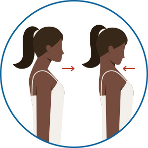 Head Retraction
